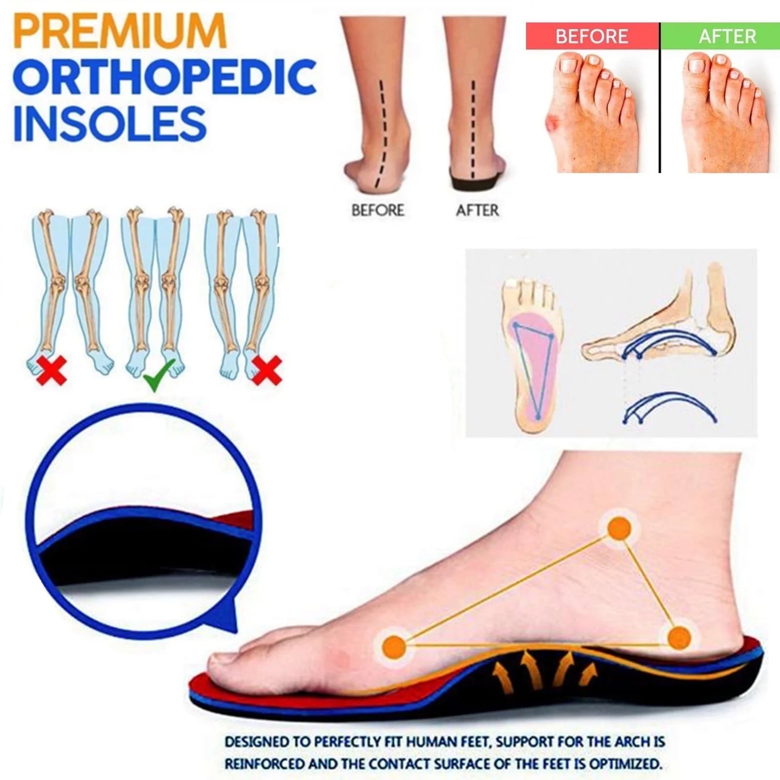 Womens Sandals Plantar Fasciitis Feet Sandal with Arch Support Ladies Beach Orthopedic Sandals Non-Slip Causal Summer Flat Sandals for Women 2023, up to 65% Off!